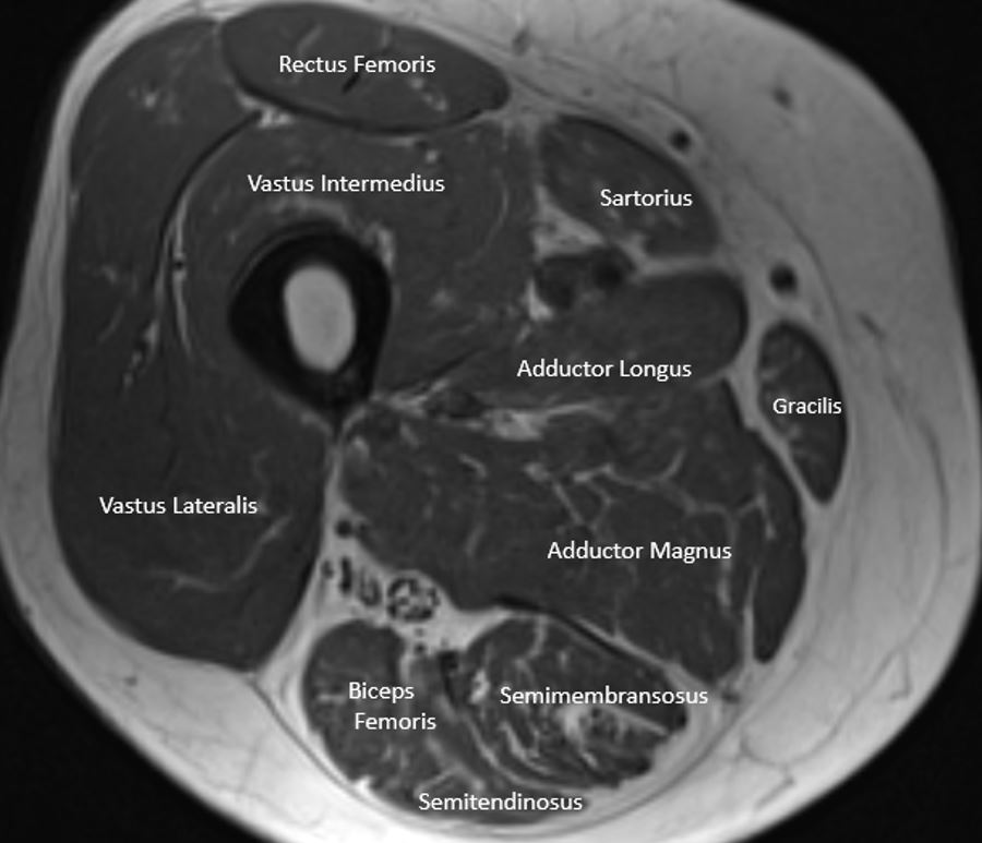 Cross section of the thigh