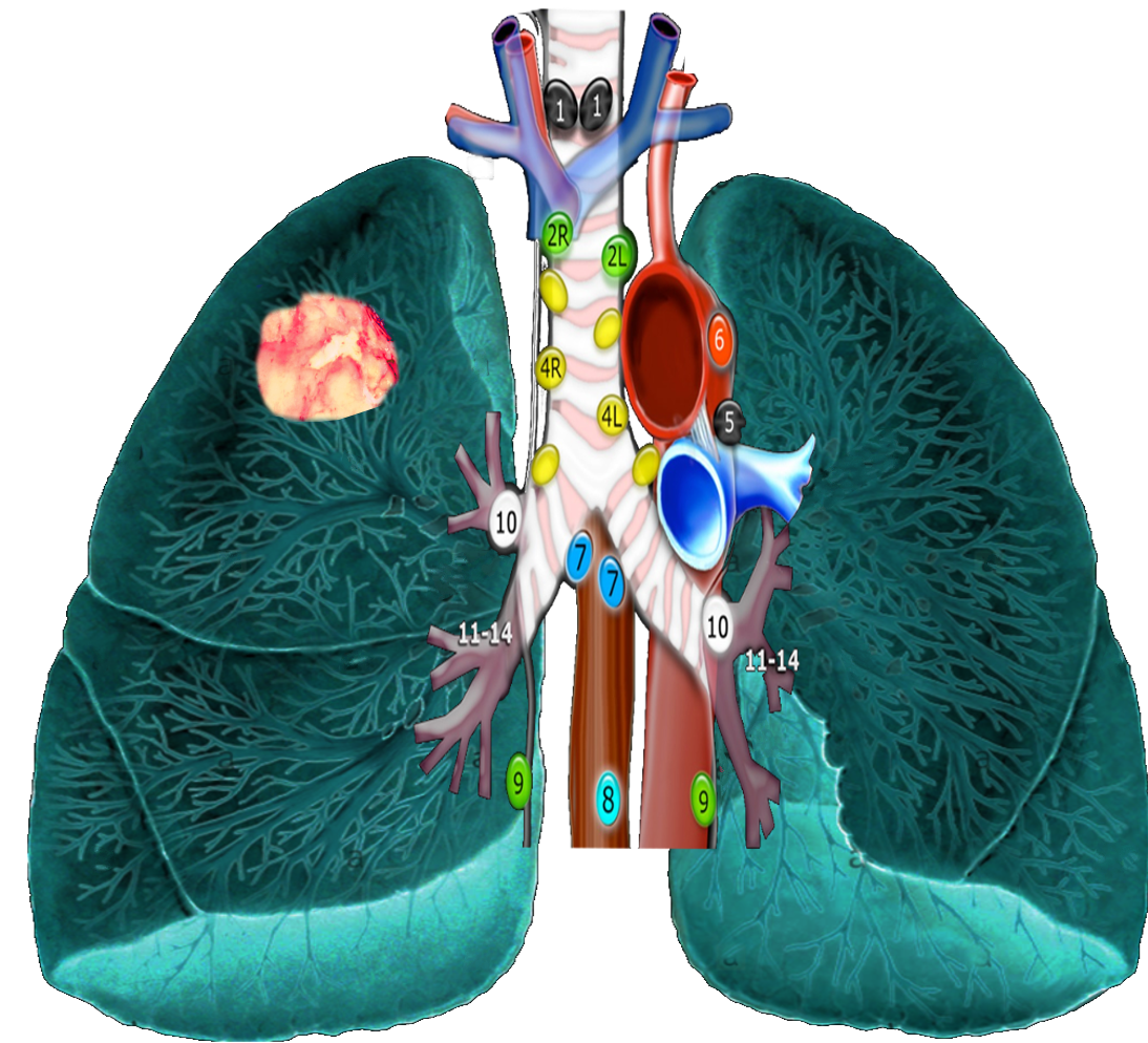 Mediastinal lymph nodes