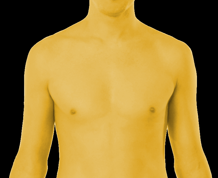 Jaundice in a male