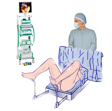 lithotomy position