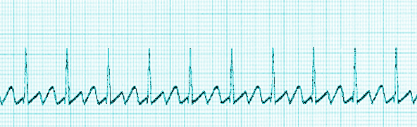 A Flutter, [SATA]