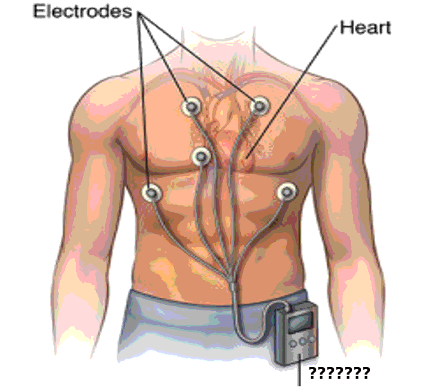 Holter monitor