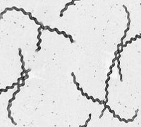 Leptospirosis on dark field microscopy