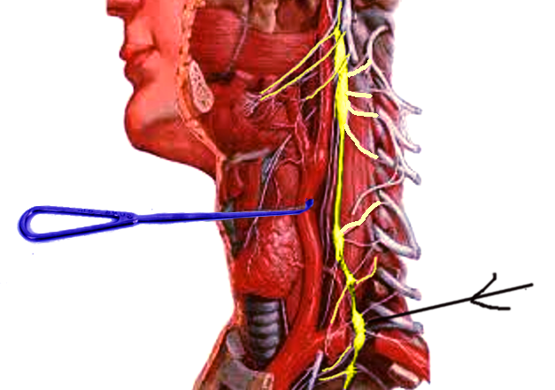 Stellate ganglion