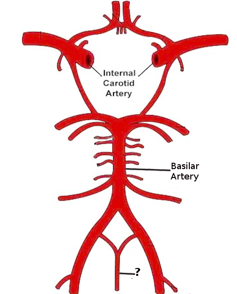 Anterior spinal artery