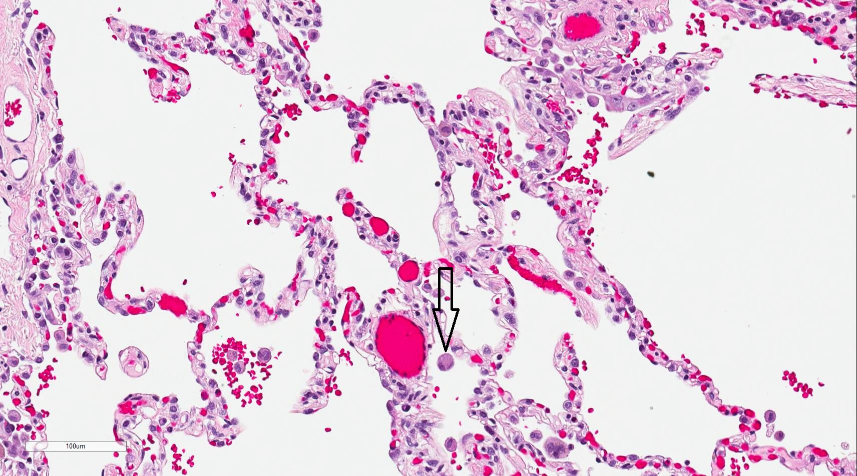 lung histology 200x