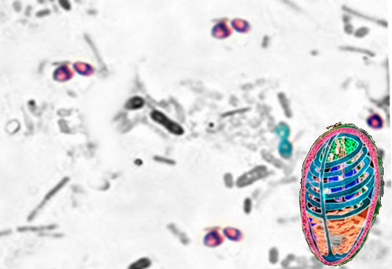 Microsporidum-light and EM