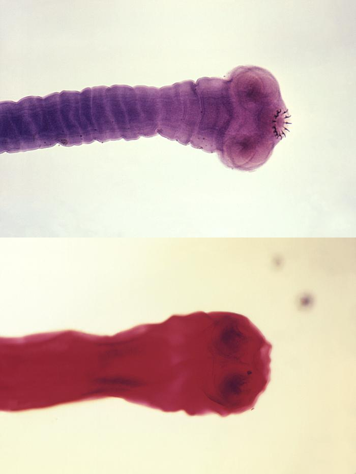 Scolex of the Taenia Saginata and Taenia Solium, Pork Tapeworm (top) and Beef Tapeworm (bottom)