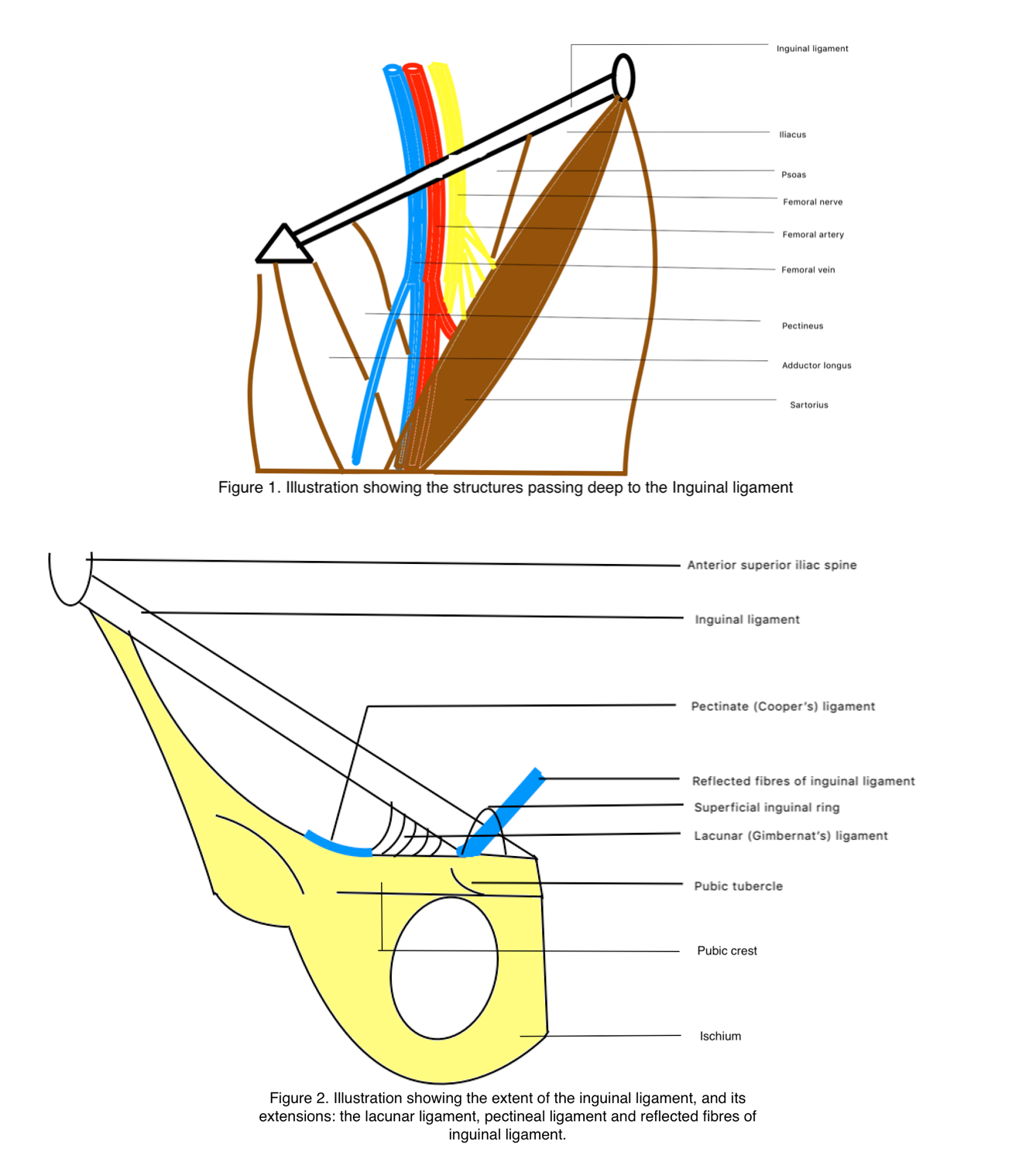 Figure 1: Structures passing deep to inguinal ligament
Figure 2: Extent and extensions of inguinal ligament